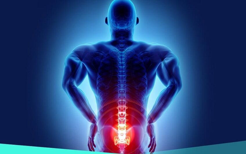 csípőízületi arthrosis okozta fájdalom